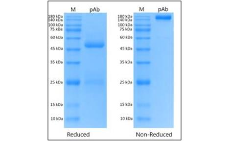 Fig. 8 A SDS-PAGE result confirms the polyclonal antibodies have been purified in high purity. (Creative Biolabs Original)