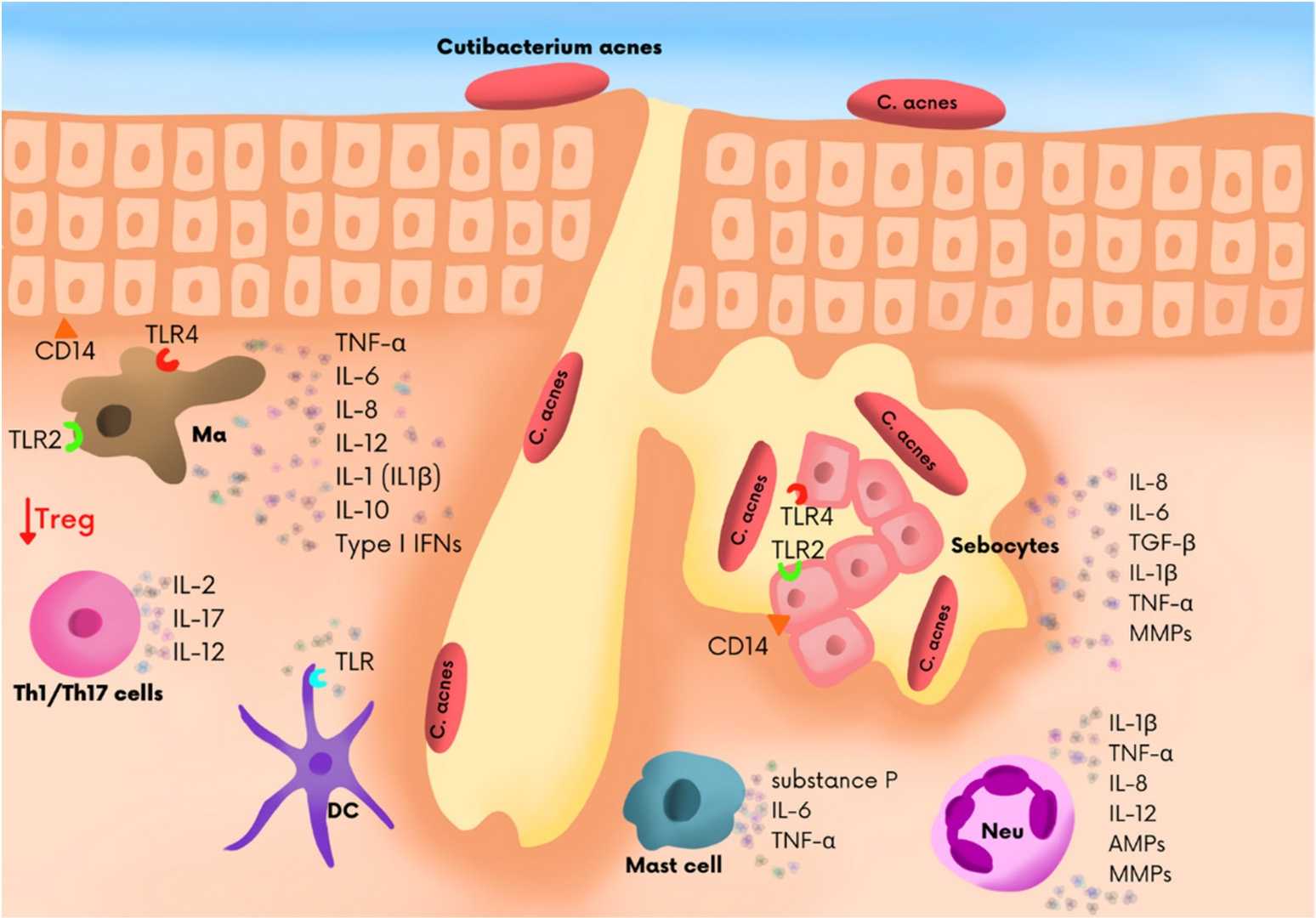 Fig. 1 Immune cell repertoire within sebaceous glands with acne vulgaris. (Firlej, et al., 2022)