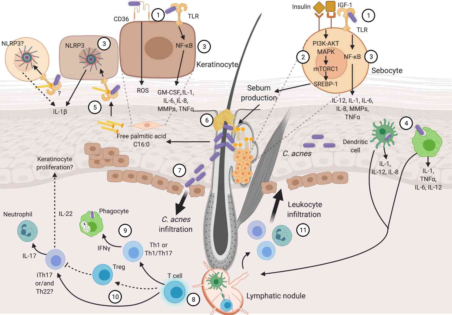 Fig.1 Acne pathophysiology related pathways. (Farfán, et al., 2022)