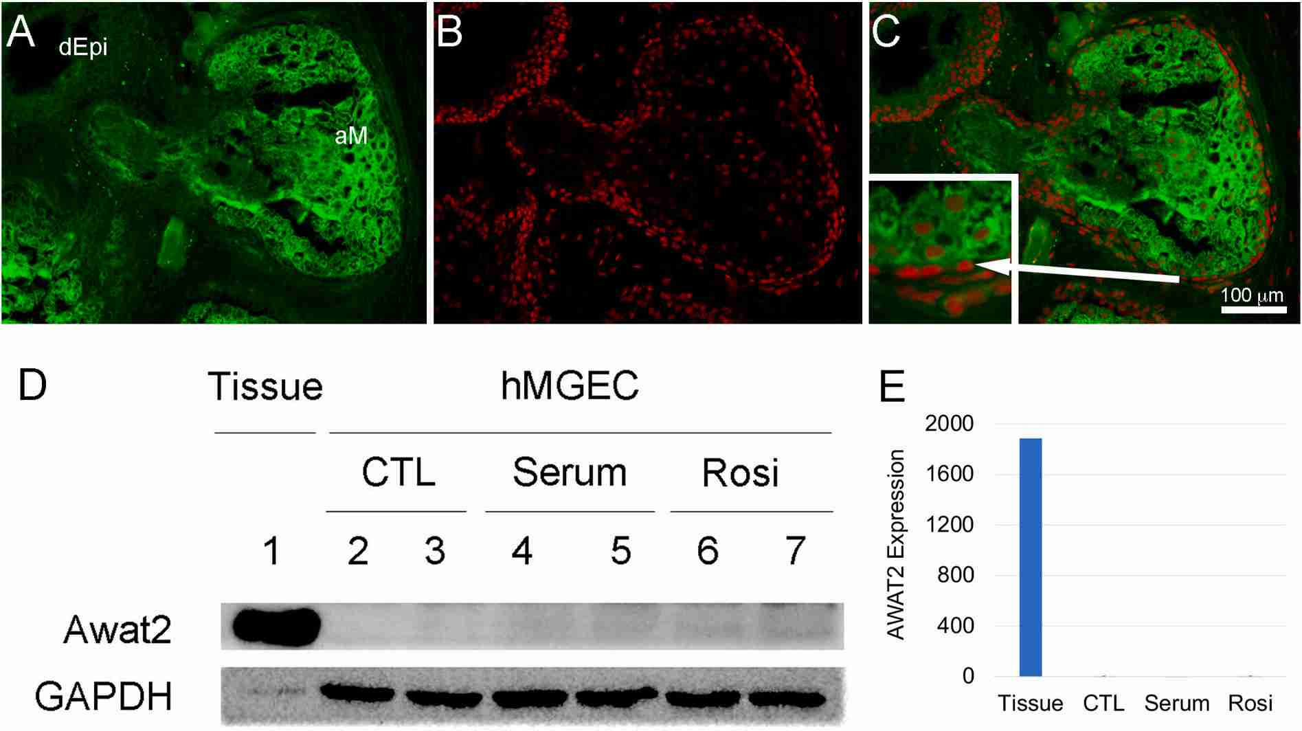 Fig.2 Analysis of AWAT2 function or expression. (Rio, et al., 2022)