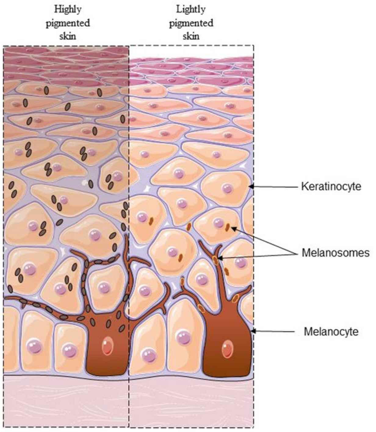 The differences of skins. (Moska & Aldo, 2023)