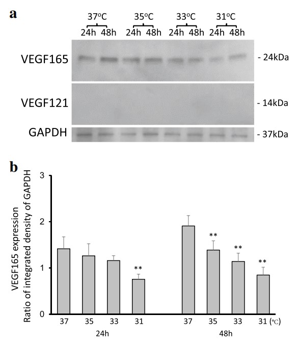 Fig.1 Immunoblotting and comparison of VEGF165 expression levels. (Takeyama, et al, 2015)