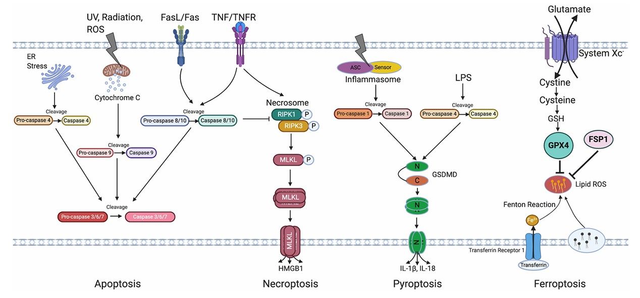 Fig. 1 RPE death pathway is involved in AMD. (Tong & Shusheng, 2020)