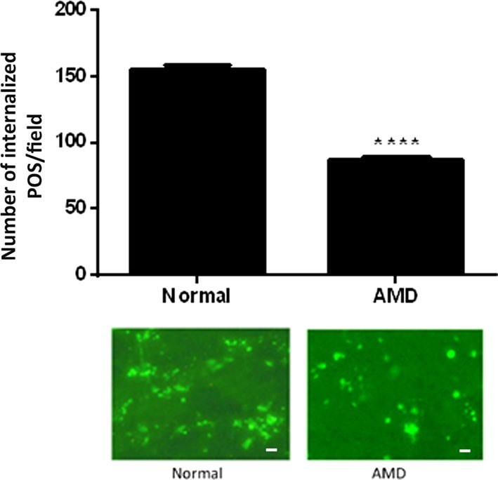 Fig.1 Evaluation of phagocytic activity in RPE cells from AMD. (Inana, et al, 2018)