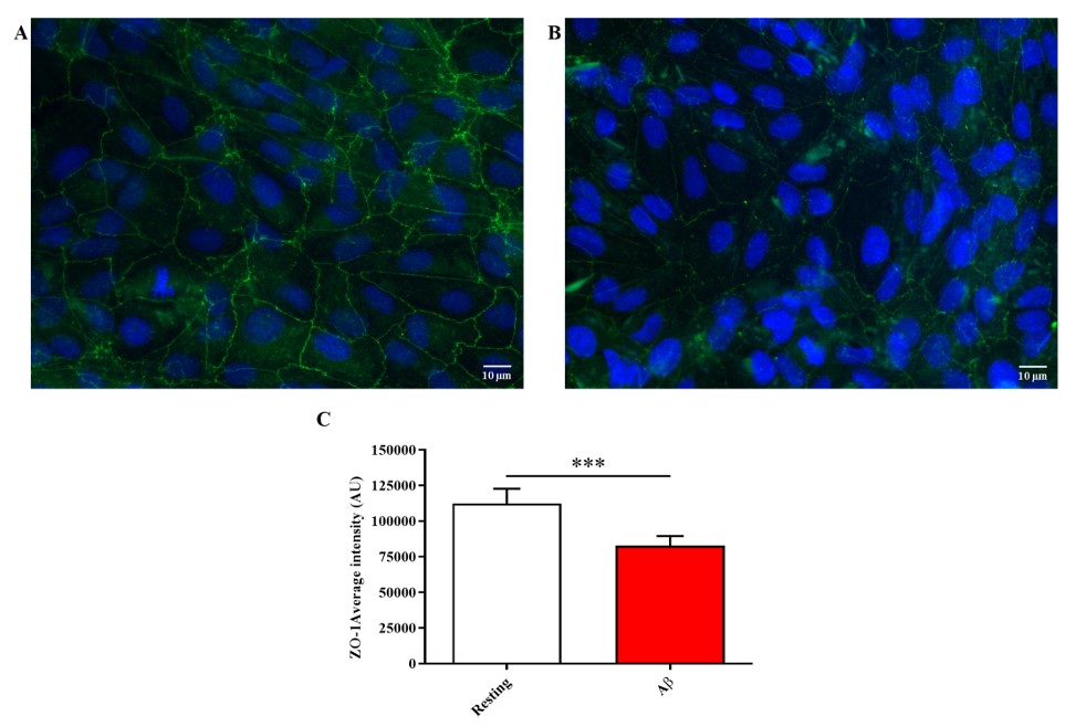 Fig.1 ZO1 expression was detected by immunochemical staining. (Caruso, et al., 2023)