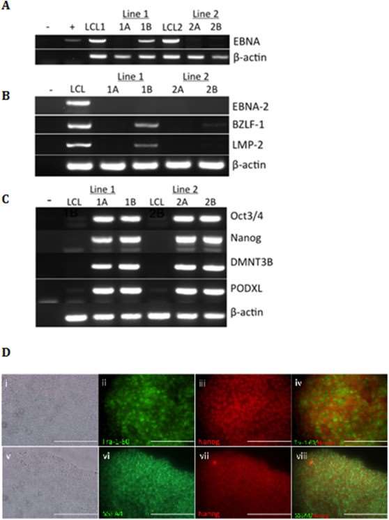 Fig. 1 LCL-derived iPSCs. (Walker, Stephen J, et al., 2021)