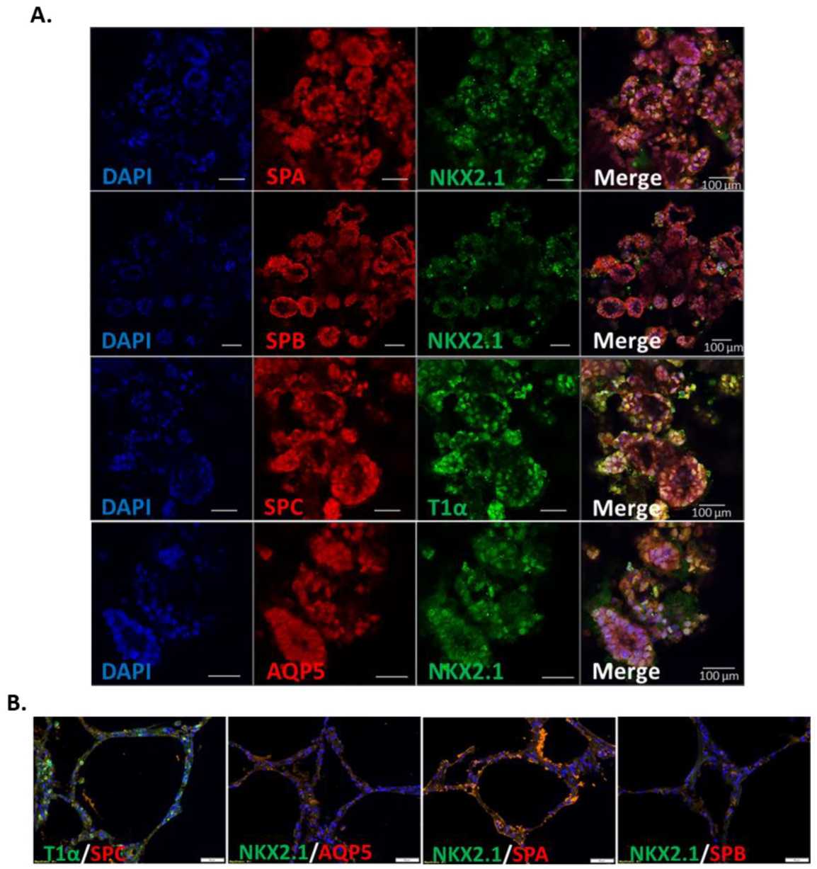 iPSC-derived pulmonary organoids. (Mitchell, Adam, et al., 2023)