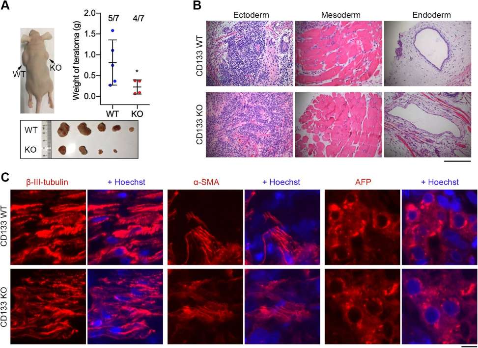 Fig. 3 Teratoma formation assay for CD133-deficient hESCs. (Wang, Hua, et al., 2020)